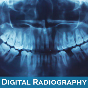 Digital Radiography